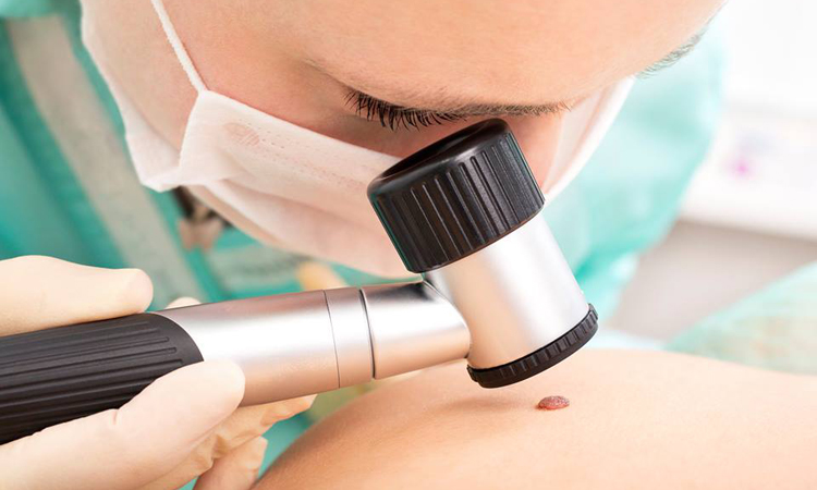 pregled dermatologa
