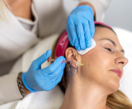 polinukleotidi obnavljanje koye